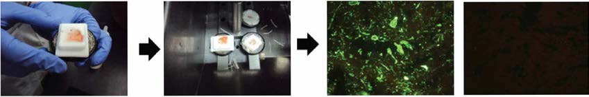 형광항체법 (FAT)으로 확인한 광견병 양성 소 뇌조직(좌) 및 음성 소 뇌조직(우). 광견병에 대한 1차항체와 형광물질이 결합되어 있는 2차 항체를 각각 1시간 반응시키고 형광현미경 에서 소뇌 purkinje 세포에서 형광이 나타나는 것을 확인