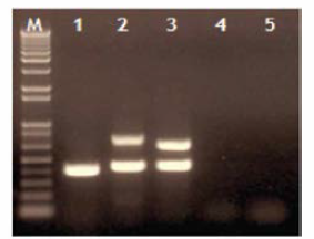 검체 시료에 대한 HP-PRRS 유전자 증폭 결과 (M： Size marker, 1： EU(Type I), 2： NA(Type II), 3： HP-PRRS 4-5： NC)