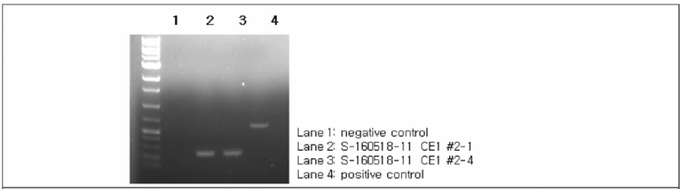 S-160518-11 conventional RT-PCR (SIV NF kit) 결과 [결과 판독; 인플루엔자 A 바이러스 M 유전자 size: 224bp, 신종인플루엔자 M 유전자 size: 452bp]
