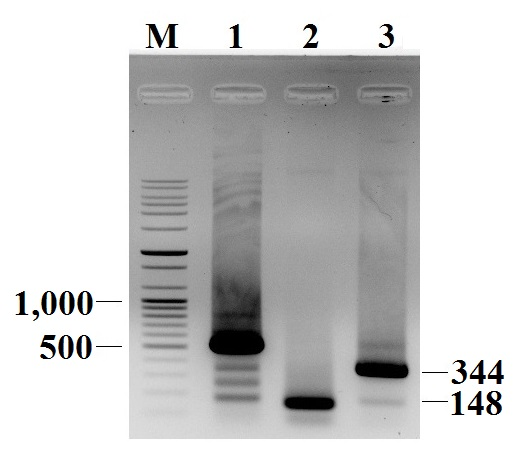 Species specific PCR detection of the ITS-1 region fragments of Eimeria spp. from fecal samples of calves with diarrhea. The bars on the right indicate the expected sizes at 148 bp and 344 bp of E. ellipsoidalis and E. zuernii, respectively. The numbers on the left represent selected size markers. Lanes: M, 100 bp plus ladder; 1, Eimeria spp. positive sample with Eimeria common primer; 2, E. ellipsoidalis positive sample; 3, E. zuernii positive sample