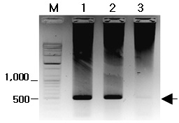 A nested PCR detection of the β-giardin gene fragments of Giardia spp. from fecal samples of calves with diarrhea. The arrow indicates the expected size with 511 bp. The numbers on the left represent selected size markers. Lanes: M, 100bp plus ladder; 1 and 3, a negative sample