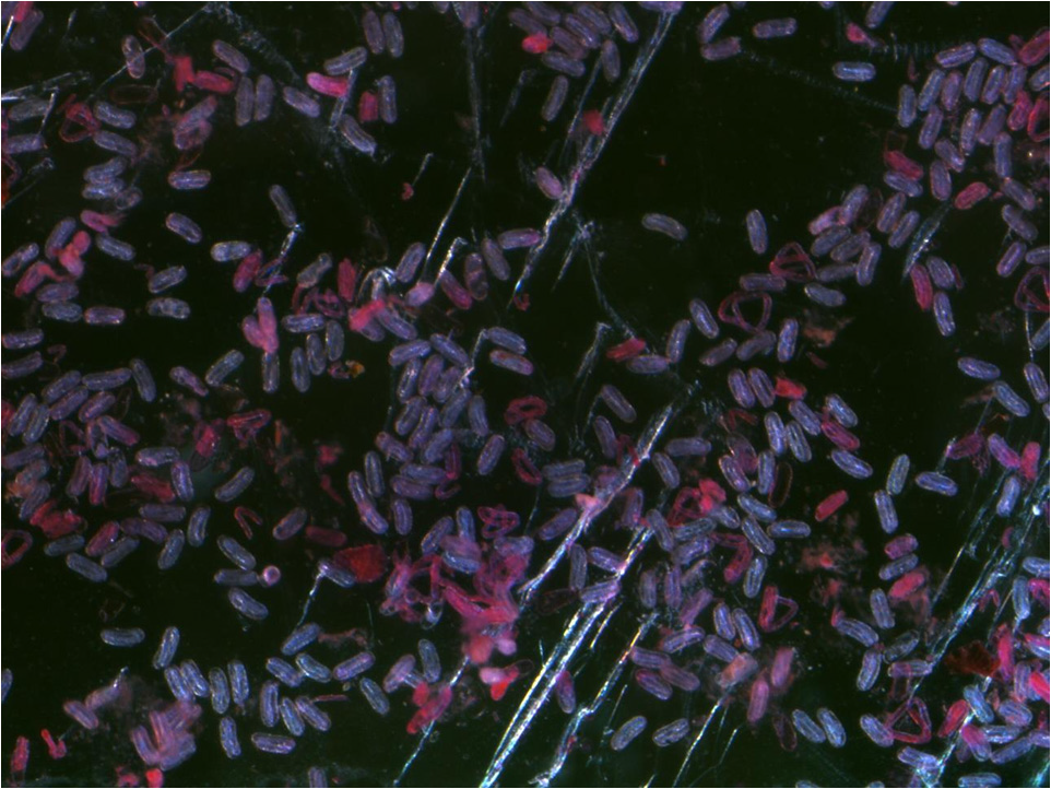 Phloxine B 선충활력 검정 결과