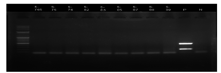 야외 광견병 너구리시료의 RT-PCR 결과 모두 음성확인