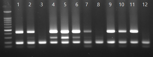 H1(435bp)+N1(288bp)+공통M (180bp) 유전자 조합을 이용한 SIV subtype에 따르는 endemic lineage 진단