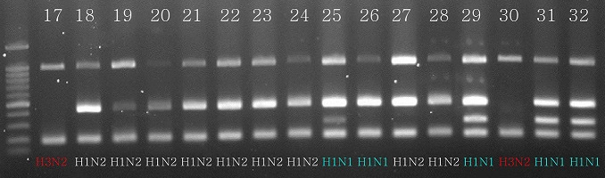 PB1(1146bp)+H1(435bp)+N1(288bp)+M(180bp)유전자 조합을 이용한 SIV endemic lineage 진단