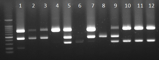 PA(719bp)+H1(435bp)+Eu/P-M(288bp) 유전자 조합을 이용한 SIV lineage 진단