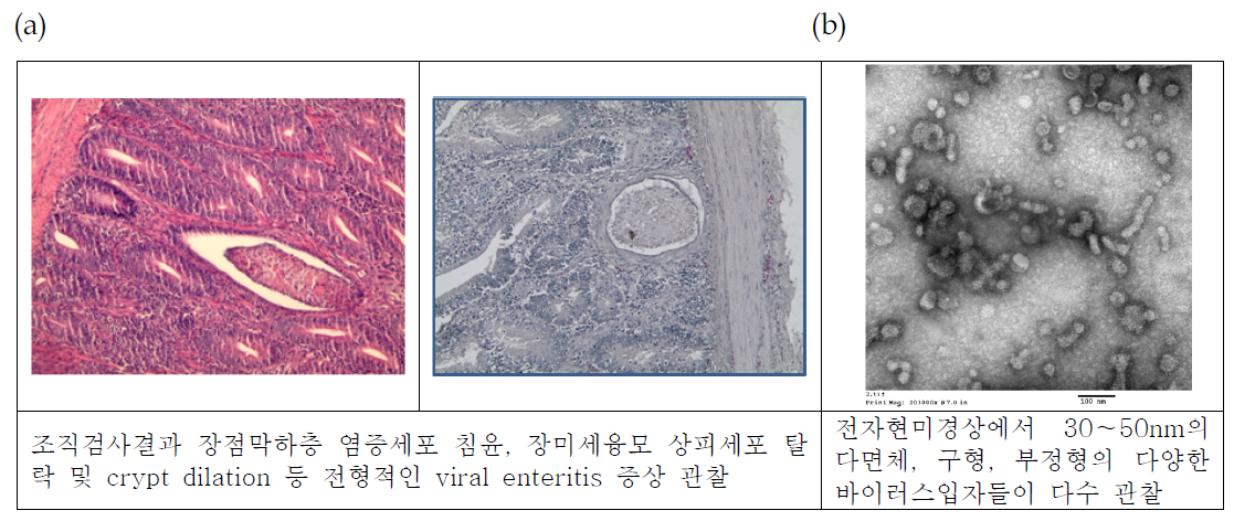 흡수불량증 케이스의 조직병변(a) 및 전자현미경 관찰 사진(b)
