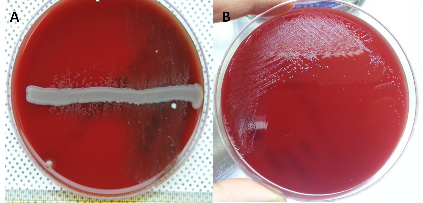 Growth of Korean isolates on blood agar with a Staphylococcus epidermidis nurse colony, NAD dependent colonies (A) or NAD independent colonies (B)