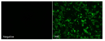 NDV cDNA 클론의 SacII site 에 GFP를 삽입하여 발현을 확인하였다