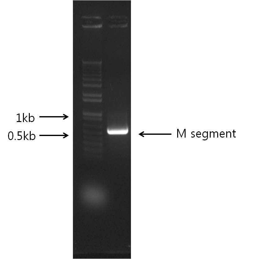 M segment의 PCR 결과