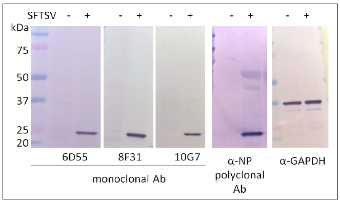 SFTSV 세포 내 NP Western blot(GAPDH 항체를 대조군으로 사용)