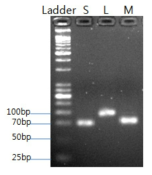 양성 clone을 이용한 RT-PCR