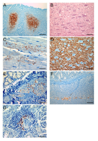 면역조직화학염색법을 이용한 변형프리온의 조직분포 A: R-MALT, B: 빗장의 DMVN(H&E), C: Heart, D: 빗장의 DMVN(IHC), E: submandibular salivary gland, F: Ileum, G: Kidney