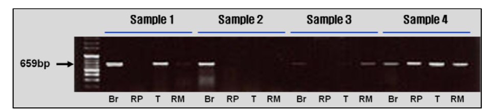 Elk PRNP gene amplification of Korean water deer. Br: Brain(Obex); RP: Retropharyngeal lymph node; T: Tonsil; RM: Rectal mucosa