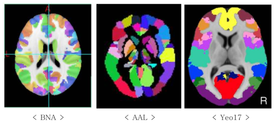 MRI data was preprocessed by fMRI pipeline. : Brain regions were specified by 3 different atlases: brainnetome atlas (BNA) - 246 ROIs : Automated anatomical labeling (AAL) atlas - 166 ROIs Yeo_17networks atlas - 17 ROIs