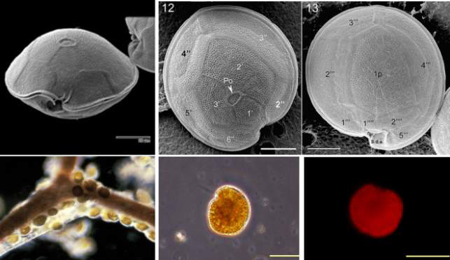 Gambierdiscus caribaeus의 광학현미경 및 주사전자현미경 사진 (Jeong et al. 2012 및 본 연구)