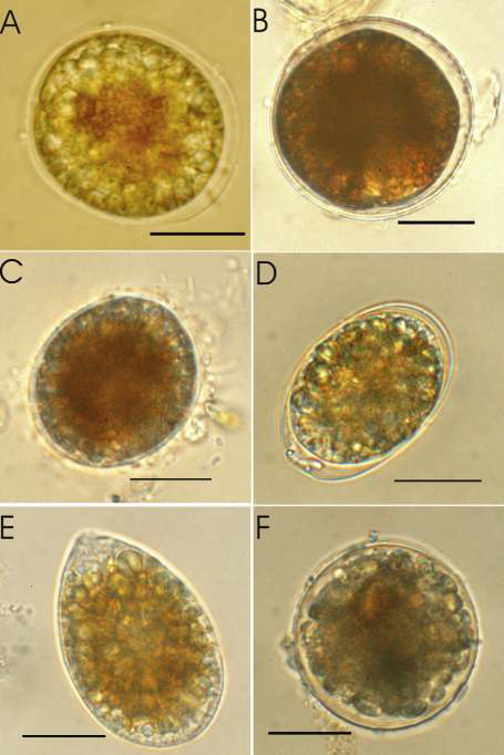 Ostreopsis cf. ovata의 휴먼포자