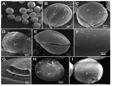 Coolia malayensis.의 주사전자현미경(SEM)을 통한 형태학적 관찰