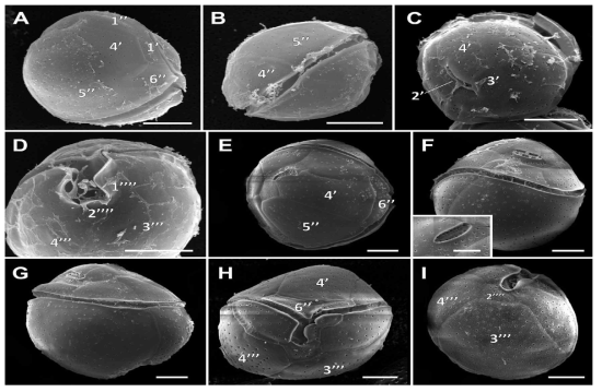 Coolia monotis와 Coolia tropicalis의 주사전자현미경(SEM)을 통한 형태학적 관찰