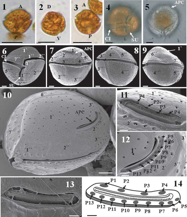 Coolia canariensis 한국 종주의 광학현미경(LM), 주사전자현미경 (SEM)을 통한 형태학적 관찰
