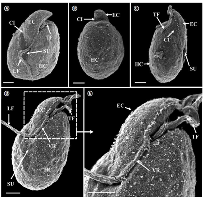 Amphidinium massartii 의 전자 현미경 사진. Ⓐ 복부보기 혀 모양의 epicone (EC), cingulum (CI), transverse flagellum (TF), sulcus (SU), 종축 (LF), hypocone (HC). Ⓑ Dorsal view showing EC, CI 및 HC. Ⓒ 배측 편평한 EC, TF, SU, CI 및 HC를 보여주는 측면도. Ⓓ EC, LF, TF, SU, HC, 복부 융기 (VR). Ⓔ EC, TF 및 VR을 나타내고, 2D의 확대. 눈금 막대는 A-E, 2 μm를 나타냄