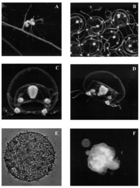 Bougainvillia sp. : (A) hydranth with two medusa buds; (B) group of newly released medusae; (C) adult 16-day-old medusa; (D) 21-day-old medusa; (E) armed egg with several cnidocytes on its surface (×270); (F) a vital manubrium has released an egg