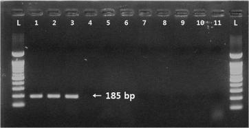 큰다발이끼벌레(B. neritina) 분자마커 (BuNe_SF and SR) 적용 Agarose gel 사진. 1~3 lane: 큰다발이끼벌레. 4~11 lane: 4, 한구멍이끼벌레; 5, 세방가시이끼벌레; 6, 자주빛이끼벌레; 7, 관히드라; 8, 분홍멍게; 9, 유령멍게; 10, 별불가사리; 11, 아무르불가사리