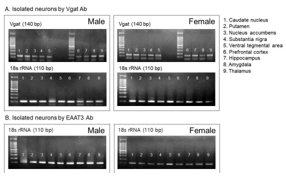 퇴행성 뇌질환 실험의 대조군 영장류의 9개 뇌영역을 샘플링하여 Glu/GABA 신경세포 분리 후 RT-PCR 분석