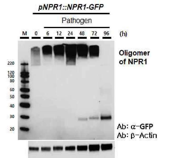 병원균 감염 후, total 단백질에서 NPR1의 변화 관찰