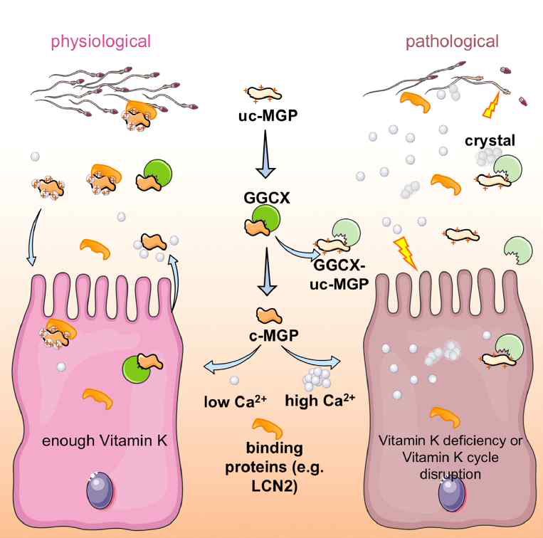 비타민 K-의존성 단백질인 MGP(matrix gla protein)의 고유기능위한 비타민K 역할