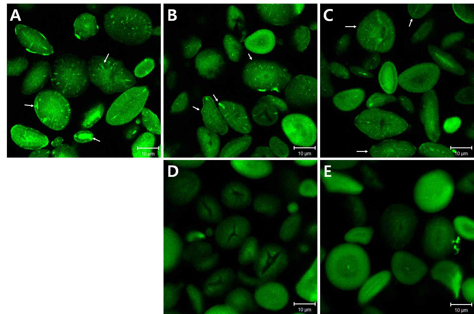 CLSM images of native wheat starch (A) and the protease-treated wheat starch (B-D) subjected to pronase (B & D) and protease K (C & E) treatments at 4℃ (B & D) and 37℃ (D & E), followed by CBQCA labeling (scale bar=10 μm)