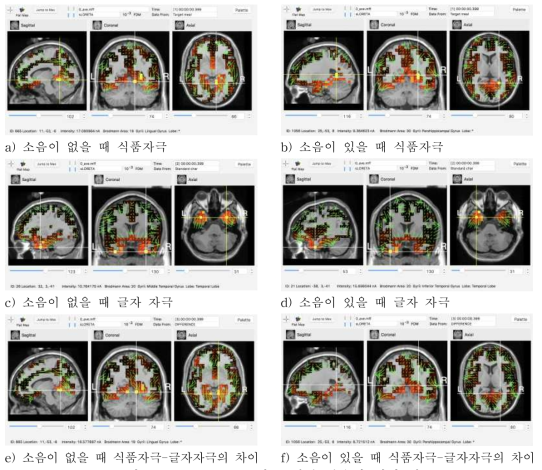 표준 MRI 뇌 모델에 적용한 뇌파 강도