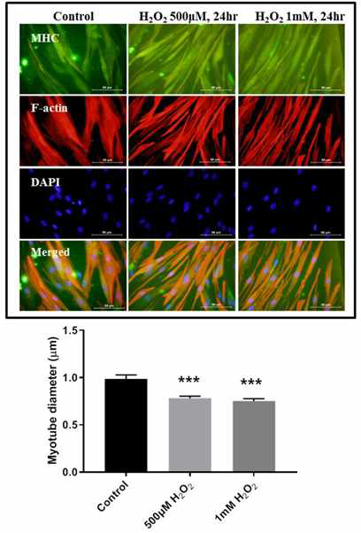 Human skeletal muscle myoblast에서 atrophy 유도 조건 확립 (자체생성)