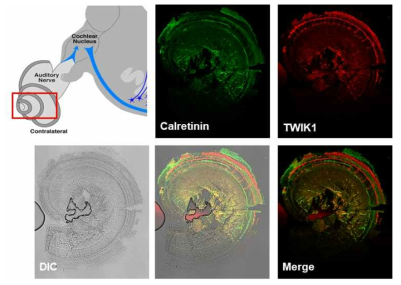 성체 생쥐의 와우각에서 Calretinin과 TWIK-1 면역 염색 결과 (자체생성)