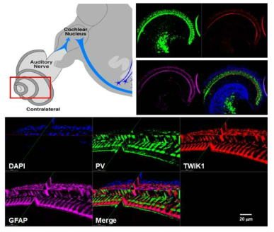 성체 생쥐의 와우각에서 Parvalbumin, GFAP와 TWIK-1 면역염색 결과 (자체생성)
