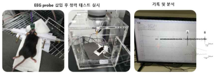 EEG 측정을 이용한 청력 측정 (자체생성)