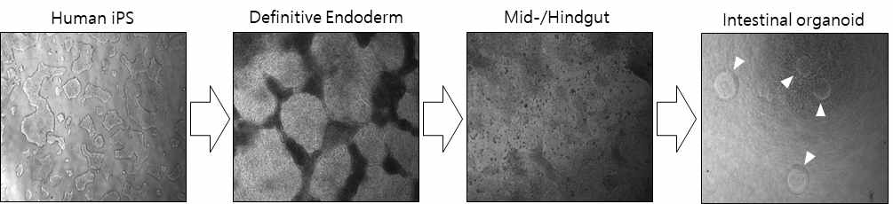 유도만능줄기세포로부터 대장오가노이드 분화 유도