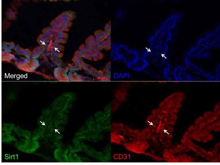 lmmunofluoroscence study of Sirt1 and PECAM-1 in renal tissue of wild type mouse (Sirt1co/co; VE-cadherin-Cre (-)) and Sirt1 conditional KO mouse (Sirt1co/co; VE-cadherin-Cre (+)). Kidneys were harvested at 8 weeks after birth