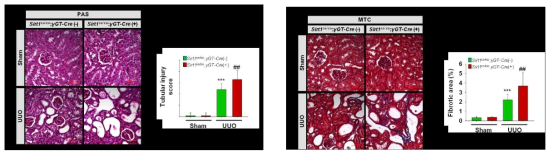 SIRT1 deficiency in the proximal tubular promotes renal injury and fibrosis in UUO mouse. (A) Periodic acid-Schiff (PAS) stained sections of kidneys from sham and UUO operated of Sirt1co/co;γGT-Cre(-) and Sirtt1co/co;γGT-Cre(+) mice. Bar=50 μm. (B) The graph shows semiquantitative scoring of tubular injury showed more damage in Sirt1co/co;γGT-Cre(+) UUO mice compared with Sirt1co/co;γGT-Cre(-) UUO mice (n = 15 per group). Data are expressed as mean ± SD. ***P < 0.001 versus Sirt1co/co;γGT-Cre(-) sham; ##P < 0.01 versus Sirt1co/co;γGT-Cre(-) UUO. (C) Masson's trichrome stained sections of kidneys from sham and UUO operated of Sirt1co/co;γGT-Cre(-) and Sirt1co/co;γGT-Cre(+) mice. Bar=50 μm. (D) Bar chart shows area fraction (%) of tubulointerstitial fibrosis in the sham and UUO operated kidneys after 1 weeks of surgery. Ten non-overlapping randomly chosen fields at a magnification of x 200 were quantified (n = 15 per group). An significantly increase in fibrotic area was observed in Sirt1co/co;γGT-Cre(+) UUO mice compared with Sirt1co/co;γGT-Cre(-) UUO mice . Data are expressed as mean ± SD. ***P < 0.001 versus Sirt1co/co;γGT-Cre(-) sham; ###P < 0.001 versus Sirt1co/co;γGT-Cre(-) UUO. Sham, sham-operated mice; UUO, unilateral ureteral obstruction-operated mice