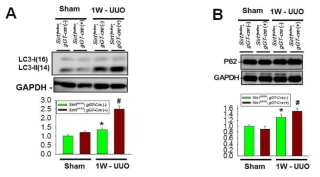 SIRT1 deficiency in the proximal tubular cell promotes autophagy in UUO mouse. Representative immunoblot analyses of LC3 (A) and p62 (B) from kidneys of sham and UUO-operated of Sirt1co/co;γGT-Cre (-) and Sirt1co/co;γGT-Cre (+) mice. The bar graph display data from densitometric analyses are presented as the relative ratio of each protein to GAPDH. The relative ratio measured in the kidneys from sham-operated Sirt1co/co;γGT-Cre(-) mice is arbitrarily presented as 1. Data are expressed as mean ± SD. **P < 0.01 versus Sirt1co/co;γGT-Cre(-) sham; # P < 0.05 versus Sirt1co/co;γGT-Cre(-) UUO