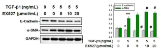 SIRT1 inhibition in the proximal tubular cells promotes UUO-induced epithelial-mesenchymal transition. Representative immunoblot analyses of a.-SMA and E-cadherin from mouse proximal tubular cell after treatment after transforming growth factor beta-1 (TGFB-1) treatment. The bar graph display data from densitometric analyses are presented as the relative ratio of each protein to GAPDH. Data are expressed as mean ± SD. *P < 0.05 versus control buffer-treated cells; **P < 0.01 versus control buffer-treated cells; #P < 0.05 versus TGFB-1-treated cells