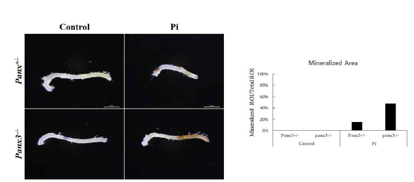 Panx3결실에 의한 Ex vivo에서의 혈관석회화