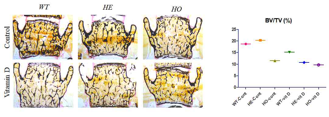 척추뼈의 Von kossa 염색을 이용한 골량 변화관찰 12주령 척추 (Lumbar 4번)을 von Kossa 염색 후 Bioquant로 측정