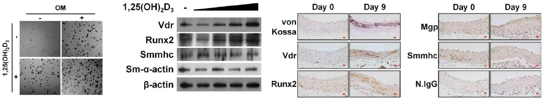 고용량 비타민 투여 시 in vitro 및 in vivo에서 혈관평활근세포의 조골세포로의 분화전환
