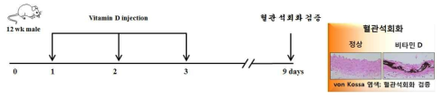 고용량 비타민 D를 이용한 혈관석회화 유도