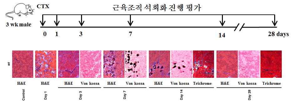 CTX 독성 유도 골격근 석회화 모델 근육에 CTX를 주입하고 제시된 시간에 따라 조직을 von Kossa 염색하면 근육 석회화를 관찰할 수 있는 모델