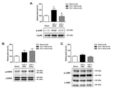 신경스테로이드 합성 효소 억제에 따른 p38, ERK, JNK MAPK 활성 변화 비교