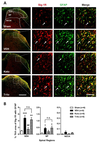 신경병증성 통증 동물 모델에서 신경스테로이드 합성 효소인 P450c17 억제에 의해 척수 별아교세포 내 시그마-1 수용체 발현이 조절됨