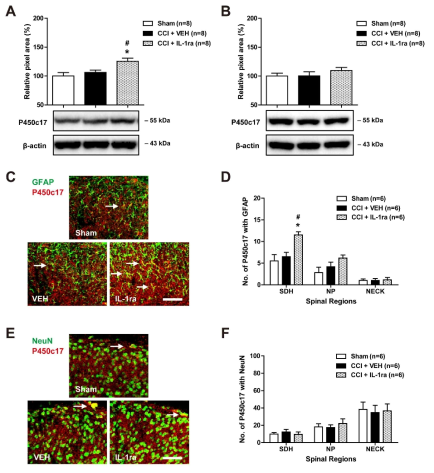 신경병증성 통증 모델에서 척수내 interleukin-1 receptor antagonist 반복 처치에 의한 별아교세포와 신경세포에서의 P450c17 발현 변화