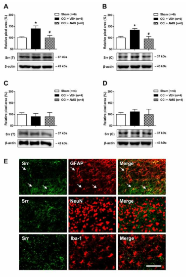 신경병증성 통증 동물 모델에서 신경스테로이드 합성 효소인 P450scc 억제제의 반복 처치에 따른 척수 별아교세포 serine racemase 발현 변화
